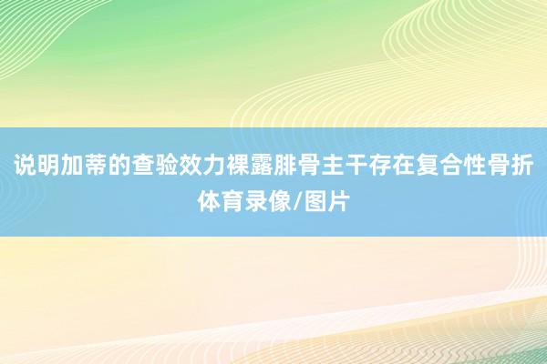 说明加蒂的查验效力裸露腓骨主干存在复合性骨折体育录像/图片